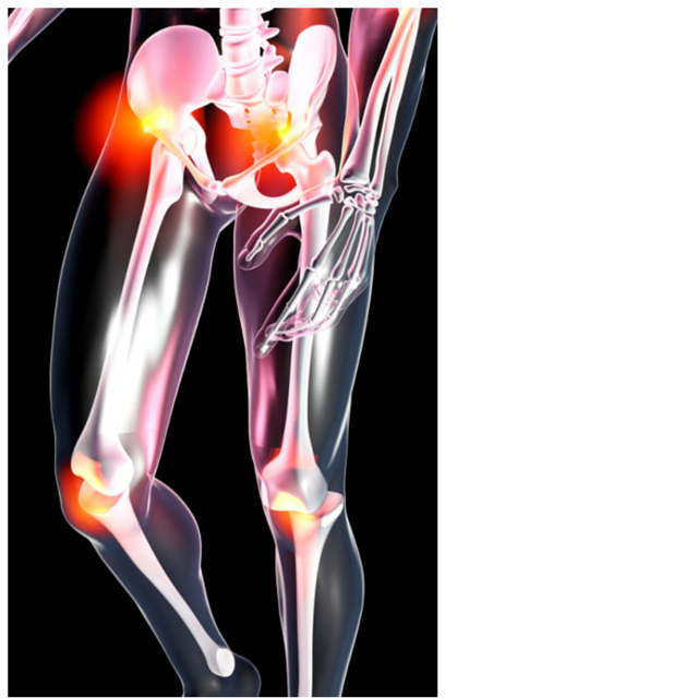 Lower Back Hip And Knee Pain Well Heeled Podiatry Melbourne