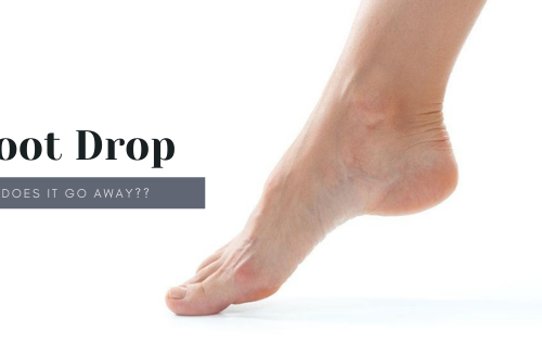 Foot Drop- Does It Go Away?